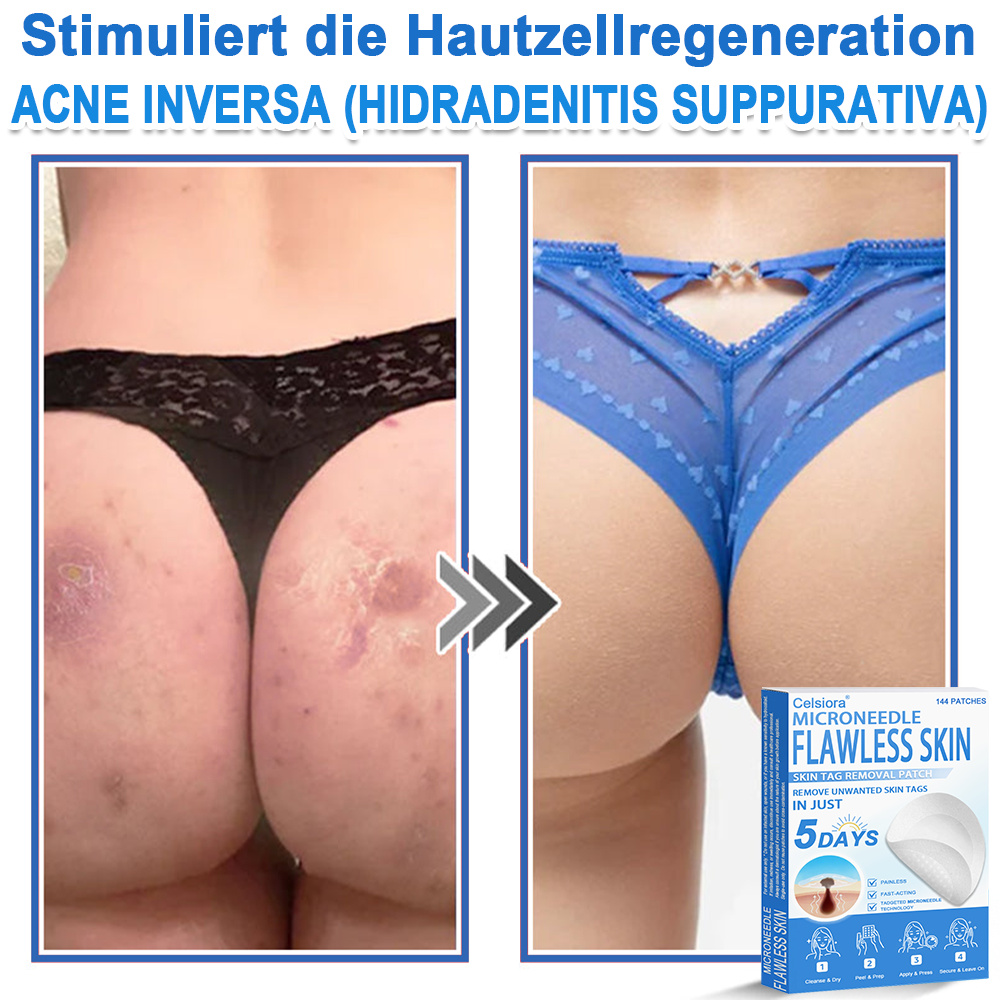 🌿Celsiora® 2-in-1 Mikronadel-Hydrokolloid-Pflaster | Gegen Hautanhängsel, Warzen, Muttermale & Akne | Glättet Falten, Narben & Hautunreinheiten | Unsichtbare Pflaster für Gesicht & Körper
