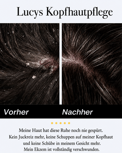 💚Celsiora® Beruhigendes Serum bei seborrhoischer Dermatitis