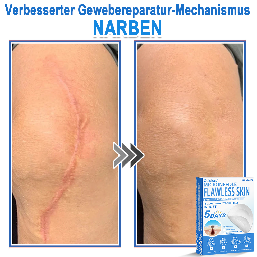 🌿Celsiora® 2-in-1 Mikronadel-Hydrokolloid-Pflaster | Gegen Hautanhängsel, Warzen, Muttermale & Akne | Glättet Falten, Narben & Hautunreinheiten | Unsichtbare Pflaster für Gesicht & Körper