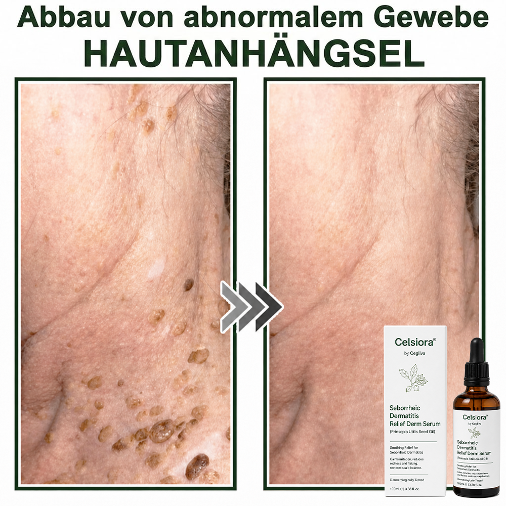 💚Celsiora® Beruhigendes Serum bei seborrhoischer Dermatitis