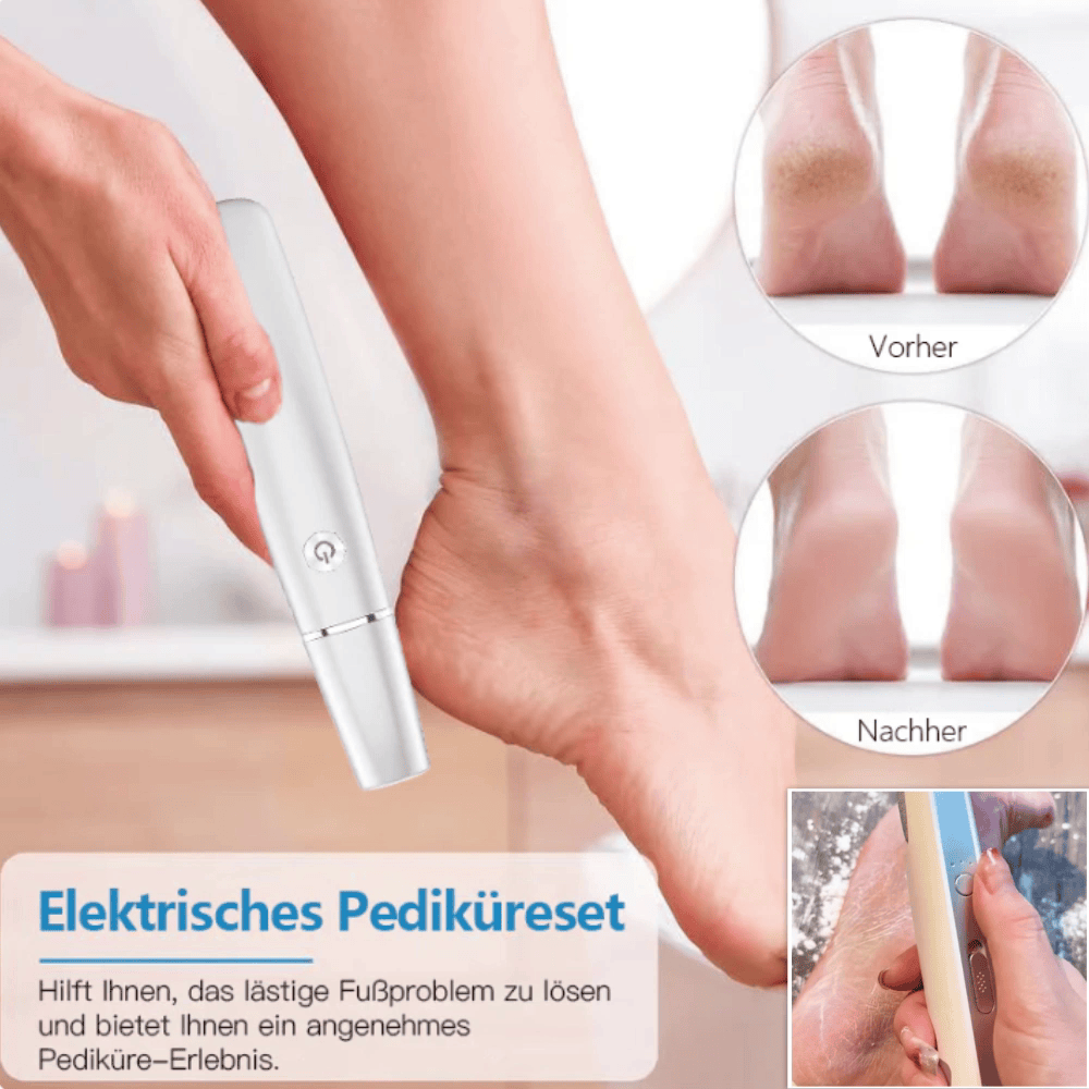 💥 Heißer Verkauf – 60 % Rabatt💥Elektrischer Hornhautentferner für die Füße👣
