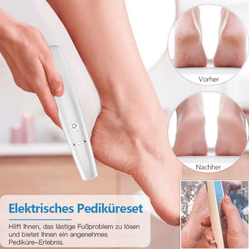 💥 Heißer Verkauf – 60 % Rabatt💥Elektrischer Hornhautentferner für die Füße👣