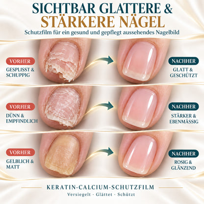 💜💅 Fliederfarbener Glanz-Nagelhärter | Leichtes Serum spendet Feuchtigkeit, stärkt die Nagelplatte & reduziert das Risiko von Nagelschäden