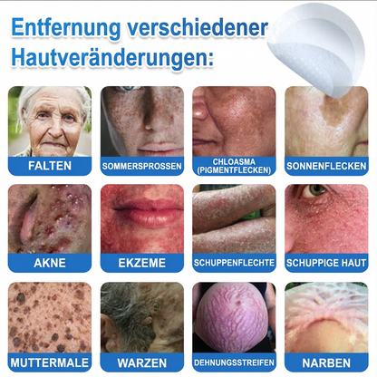 🌿Celsiora® 2-in-1 Mikronadel-Hydrokolloid-Pflaster | Gegen Hautanhängsel, Warzen, Muttermale & Akne | Glättet Falten, Narben & Hautunreinheiten | Unsichtbare Pflaster für Gesicht & Körper