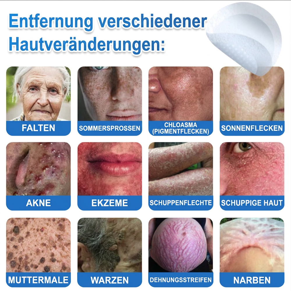 80%OFF 📌 Celsiora® 2-in-1 Mikronadel- & Hydrokolloid-Pflaster | Entferner für erhabene Muttermale, Akne, flache Warzen & Hautanhängsel | Verbessert Falten, Narben & Hautunreinheiten | Unsichtbare Stern-Pickelpflaster für Gesicht & Körper (Copy)