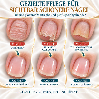 💜💅 Fliederfarbener Glanz-Nagelhärter | Leichtes Serum spendet Feuchtigkeit, stärkt die Nagelplatte & reduziert das Risiko von Nagelschäden
