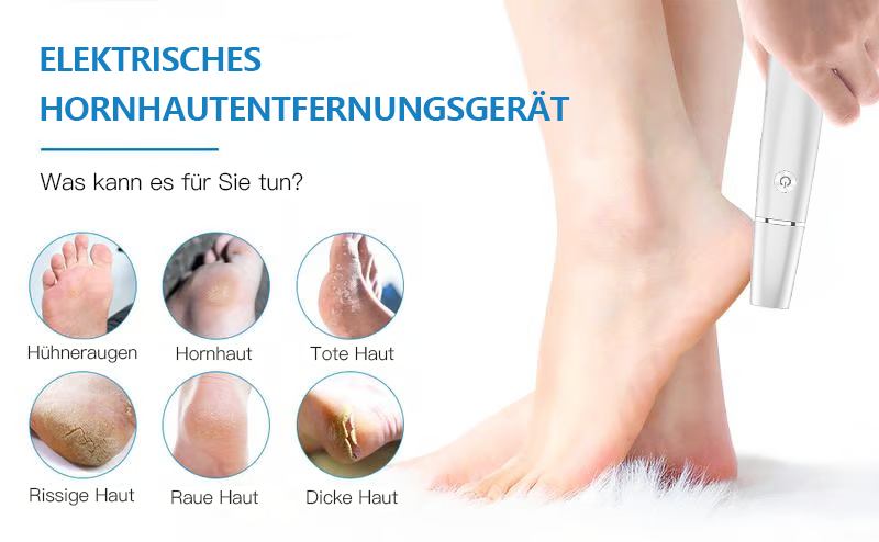 💥 Heißer Verkauf – 60 % Rabatt💥Elektrischer Hornhautentferner für die Füße👣