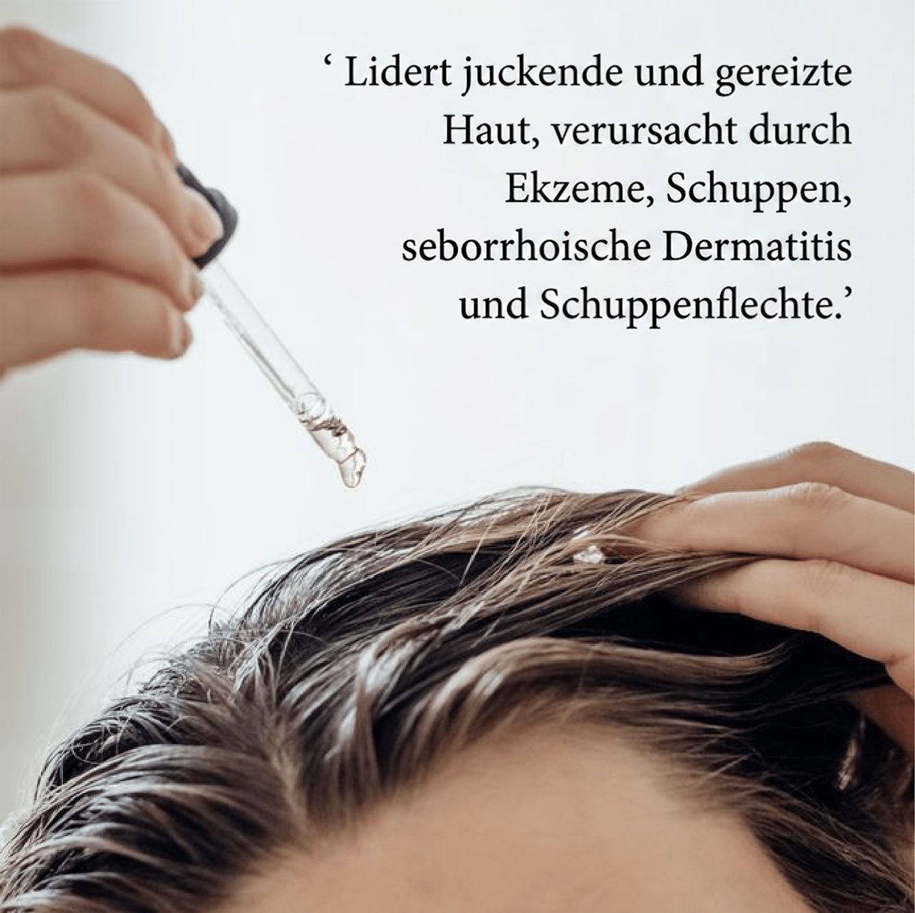💚Celsiora® Beruhigendes Serum bei seborrhoischer Dermatitis