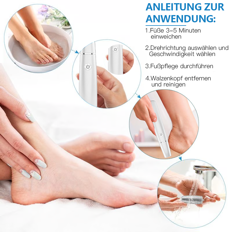 💥 Heißer Verkauf – 60 % Rabatt💥Elektrischer Hornhautentferner für die Füße👣