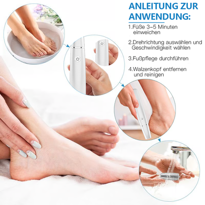 💥 Heißer Verkauf – 60 % Rabatt💥Elektrischer Hornhautentferner für die Füße👣