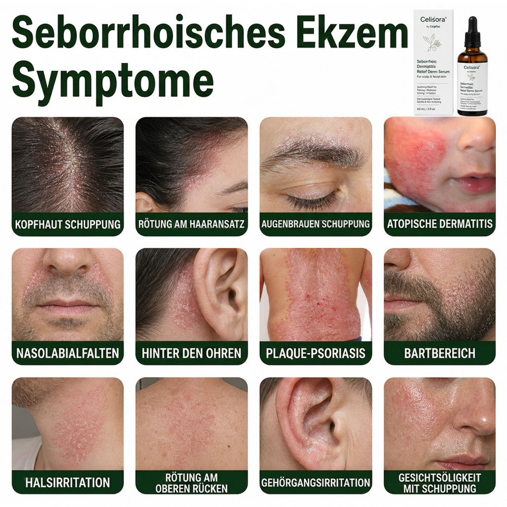 💚Celsiora® Beruhigendes Serum bei seborrhoischer Dermatitis