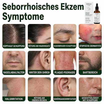💚Celsiora® Beruhigendes Serum bei seborrhoischer Dermatitis