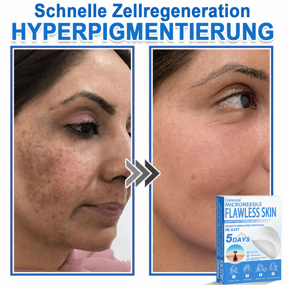 80%OFF 📌 Celsiora® 2-in-1 Mikronadel- & Hydrokolloid-Pflaster | Entferner für erhabene Muttermale, Akne, flache Warzen & Hautanhängsel | Verbessert Falten, Narben & Hautunreinheiten | Unsichtbare Stern-Pickelpflaster für Gesicht & Körper (Copy)