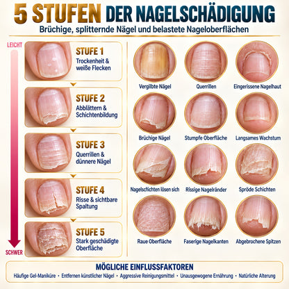 💜💅 Fliederfarbener Glanz-Nagelhärter | Leichtes Serum spendet Feuchtigkeit, stärkt die Nagelplatte & reduziert das Risiko von Nagelschäden