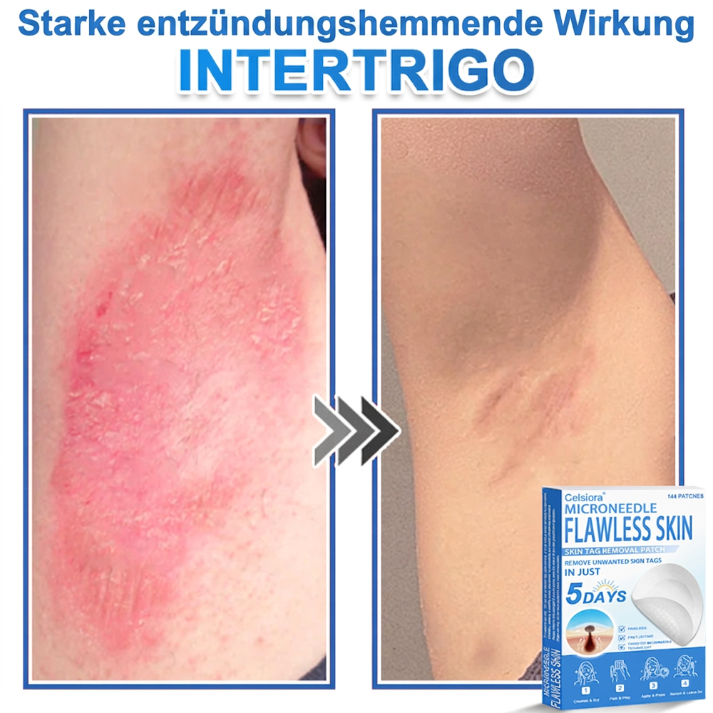 🌿Celsiora® 2-in-1 Mikronadel-Hydrokolloid-Pflaster | Gegen Hautanhängsel, Warzen, Muttermale & Akne | Glättet Falten, Narben & Hautunreinheiten | Unsichtbare Pflaster für Gesicht & Körper
